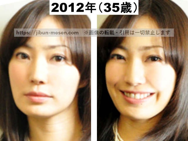 菅野美穂の表情による鼻の違いの画像