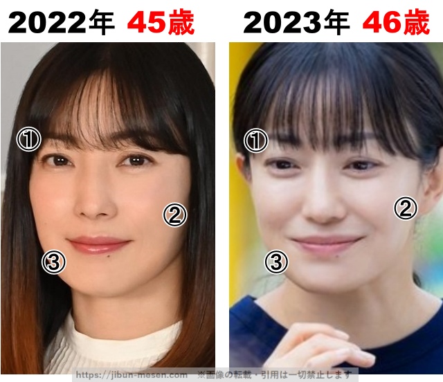 菅野美穂の整形検証2022年〜2023年の画像