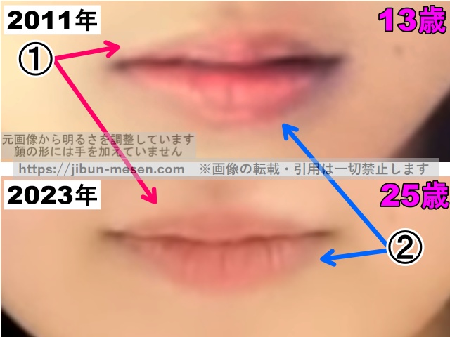 鞘師里保の唇の整形検証2011年〜2023年（拡大）の画像