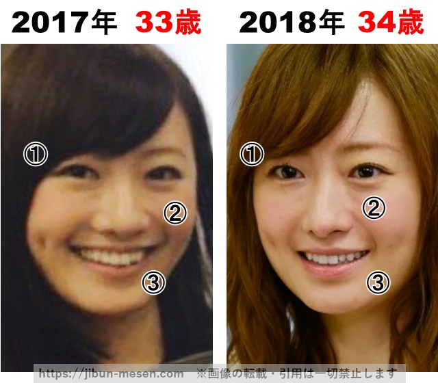 松本まりかの整形検証2017年～2018年の画像
