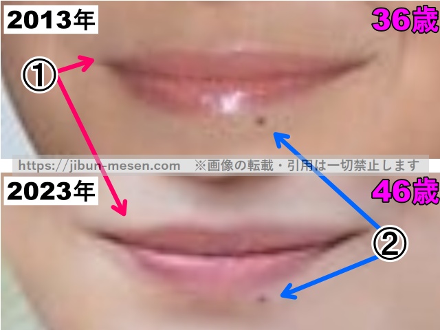 菅野美穂の唇の整形検証2013年〜2023年（拡大）の画像