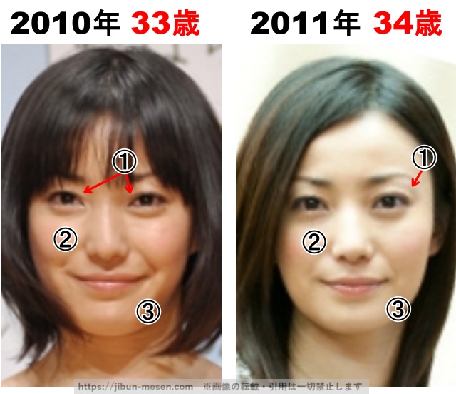 菅野美穂の整形検証2010年〜2011年の画像