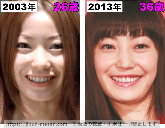 菅野美穂の唇の整形検証2003年〜2013年の画像