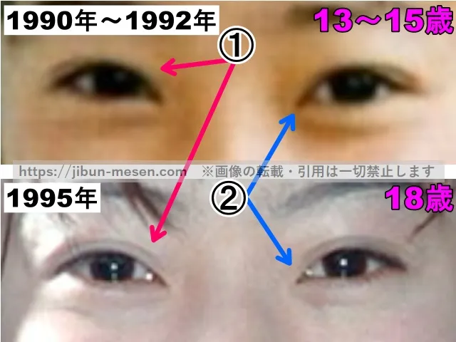 菅野美穂の目の整形検証中学生〜1995年（拡大）