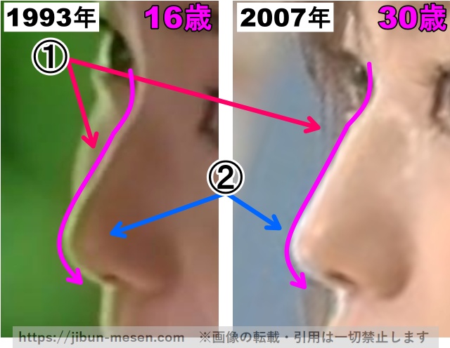 菅野美穂の鼻の整形検証1993年〜2007年（拡大）の画像