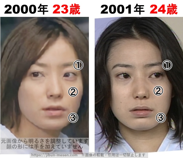 菅野美穂の整形検証2000年〜2001年の画像
