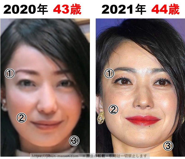 菅野美穂の整形検証2020年〜2021年の画像
