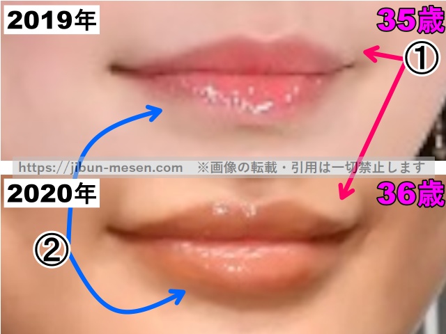 松本まりかの唇の整形検証2019年～2020年（拡大）の画像