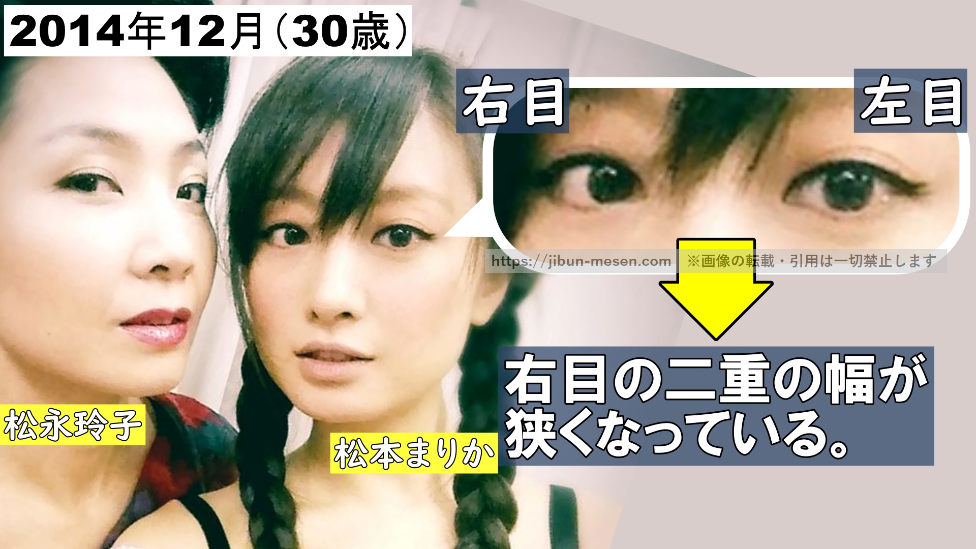 右目の二重の幅が狭くなっている。