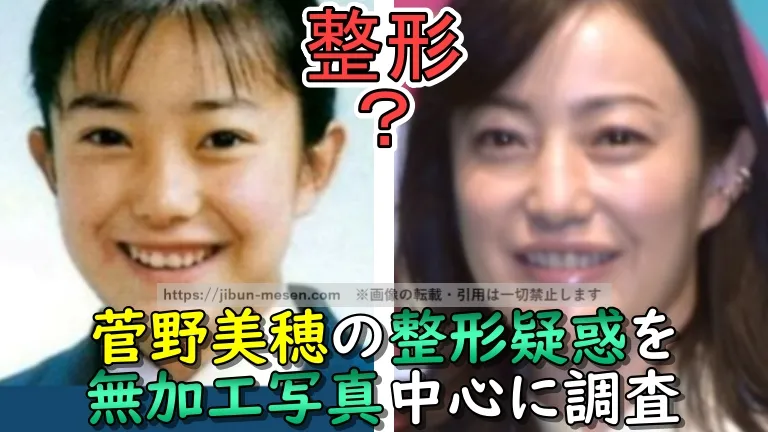 菅野美穂の整形疑惑を無加工写真中心に調査