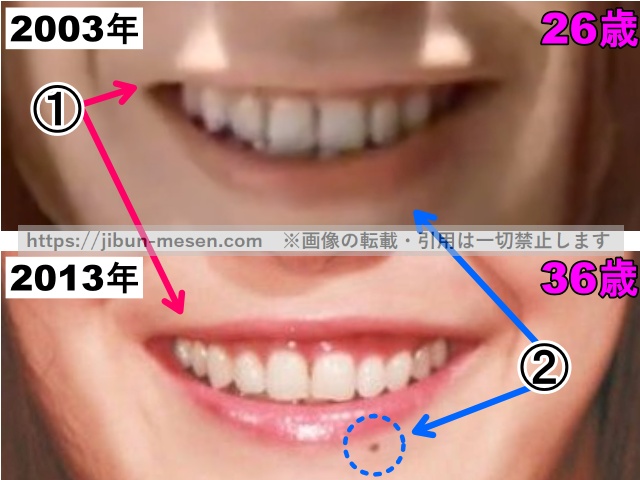 菅野美穂の唇の整形検証2003年〜2013年（拡大）の画像