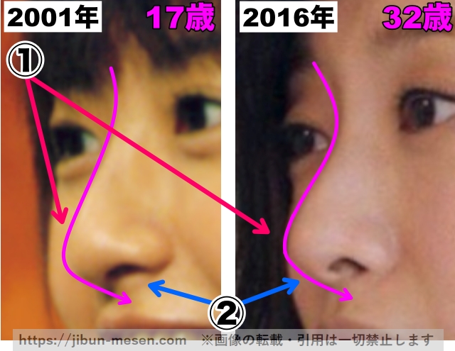 松本まりかの鼻の整形検証2001年～2016年（拡大）の画像