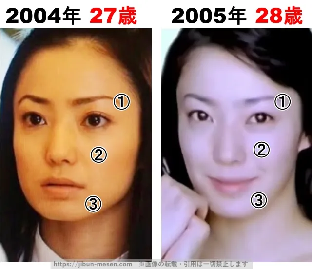 菅野美穂の整形検証2004年〜2005年