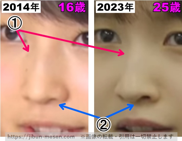 鞘師里保の鼻の整形検証2014年〜2023年（拡大）の画像