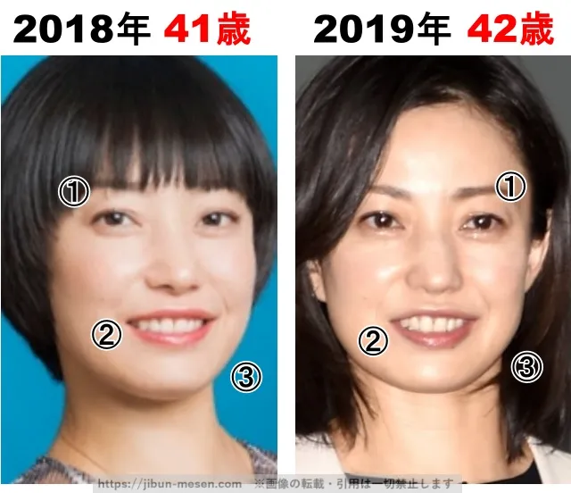 菅野美穂の整形検証2018年〜2019年
