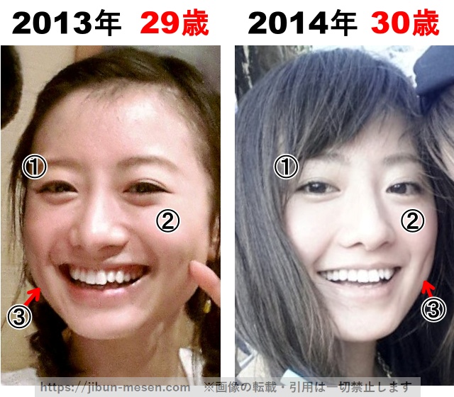 松本まりかの整形検証2013年～2014年の画像