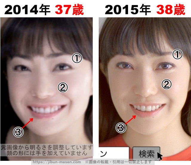 菅野美穂の整形検証2014年〜2015年の画像