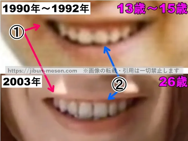 菅野美穂の唇の整形検証中学生〜2003年（拡大）