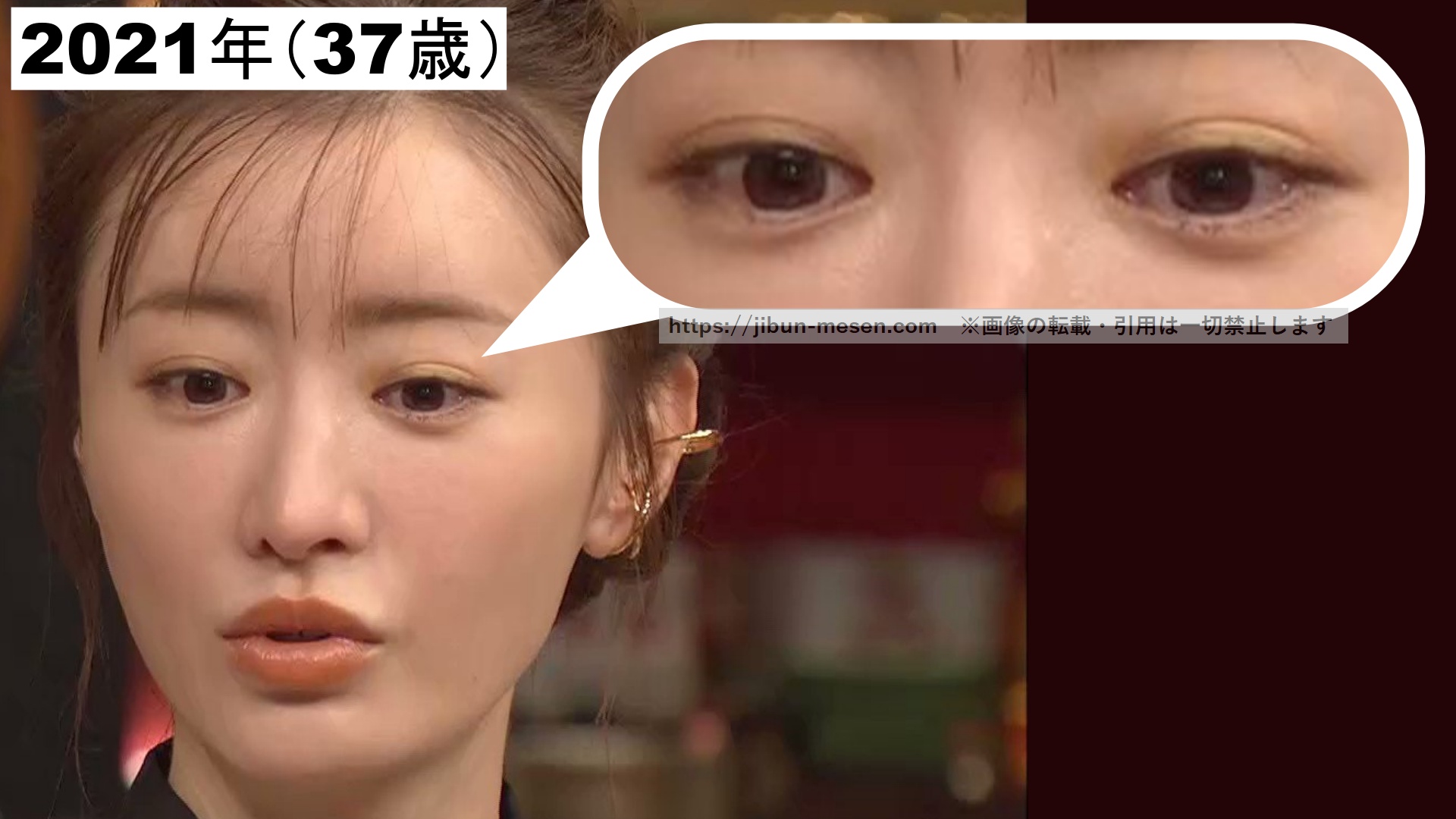 アイテープがはみ出ている松本まりかの画像