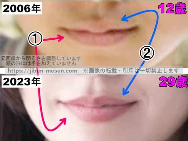 二階堂ふみの唇の整形検証2006年〜2023年（拡大）の画像
