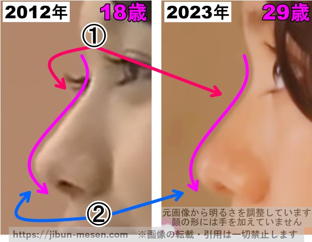 二階堂ふみの鼻の整形検証2012年〜2023年（拡大）の画像