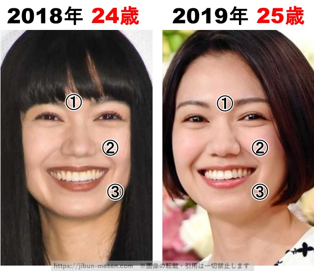 二階堂ふみの整形検証 2018年〜2019年の画像