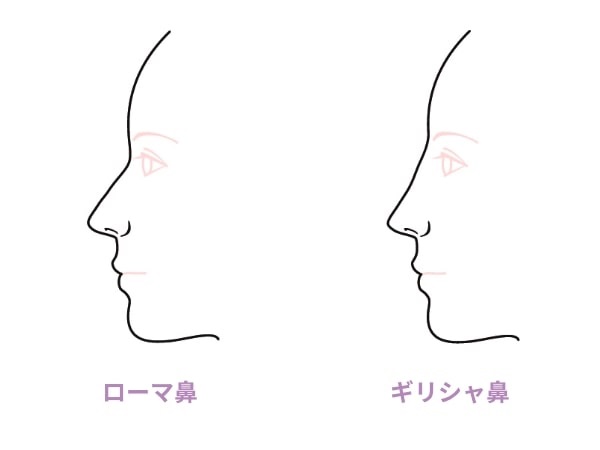 ギリシャ鼻の例（韓国美容整形navi HPより引用）の画像