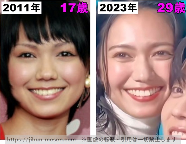 二階堂ふみの鼻の整形検証2011年〜2023年の画像