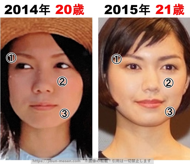 二階堂ふみの整形検証 2014年〜2015年の画像