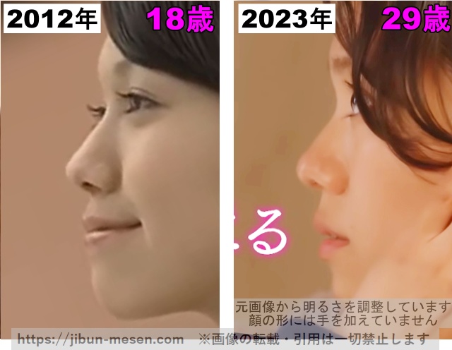 二階堂ふみの鼻の整形検証2012年〜2023年の画像