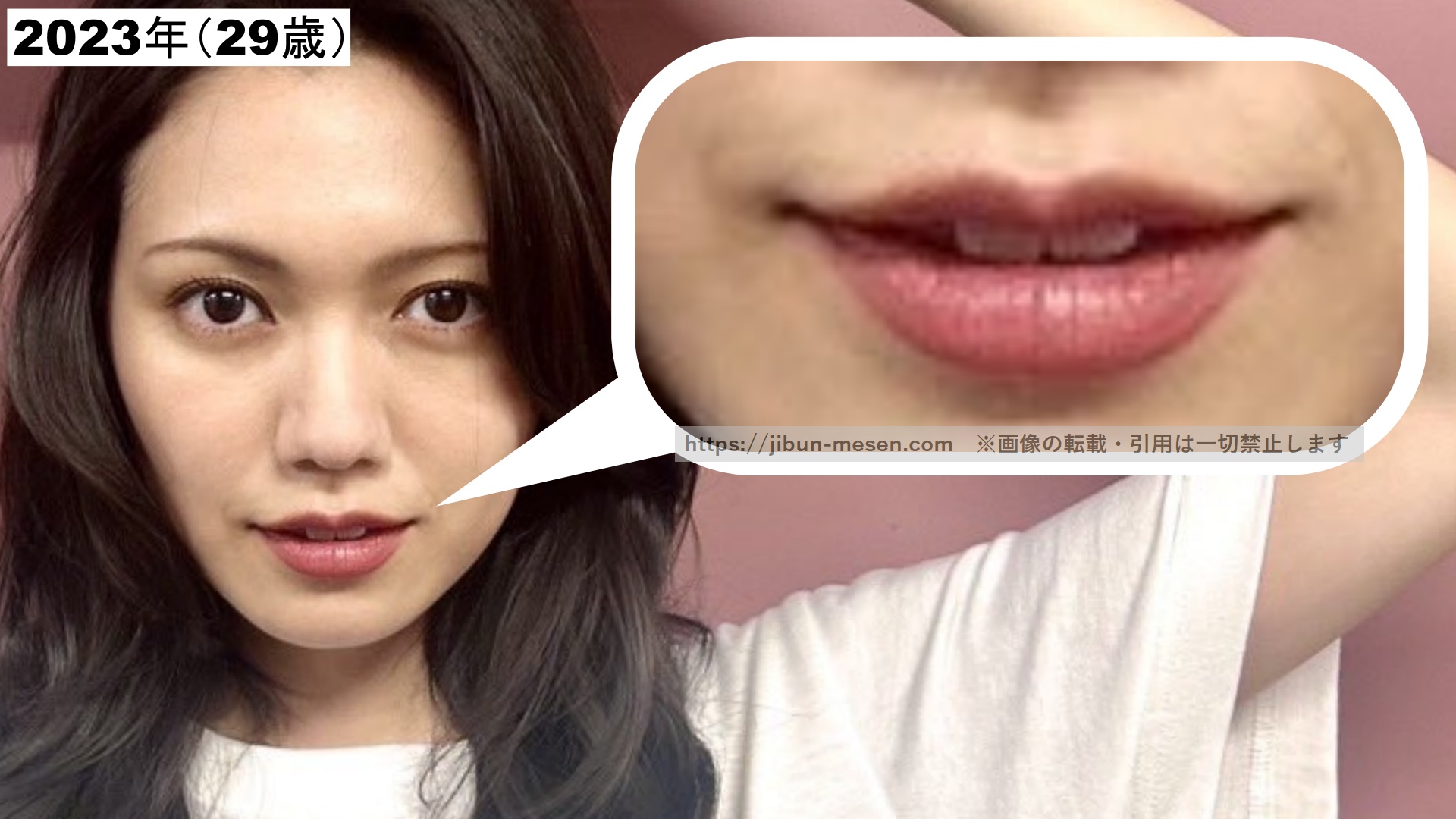 整形の可能性が低い二階堂ふみの唇の画像