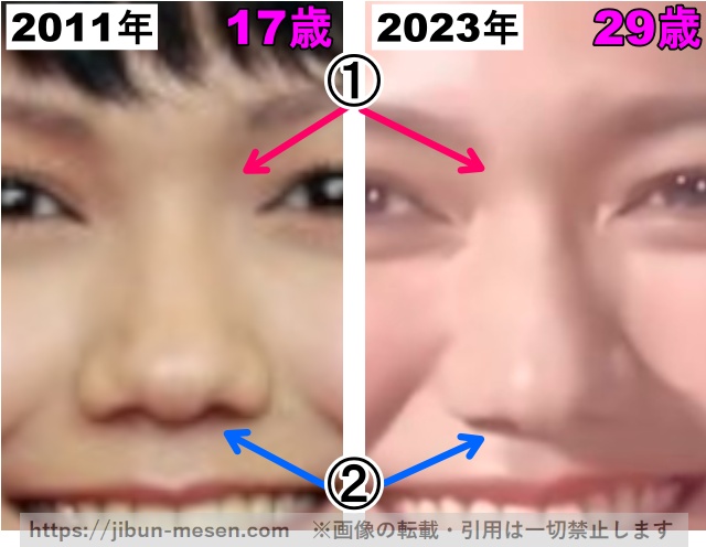 二階堂ふみの鼻の整形検証2011年〜2023年（拡大）の画像