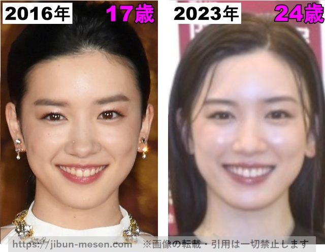 永野芽郁の鼻の整形検証2016年〜2023年の画像