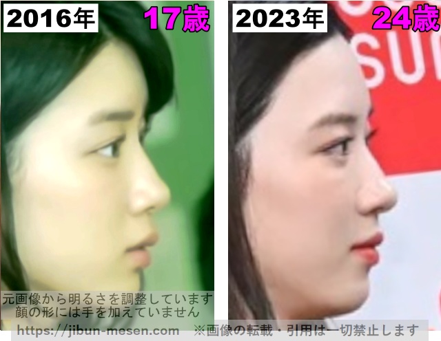 永野芽郁の鼻の整形検証2016年〜2023年（横顔）の画像