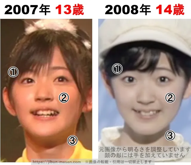 鈴木愛理の整形検証2007年〜2008年