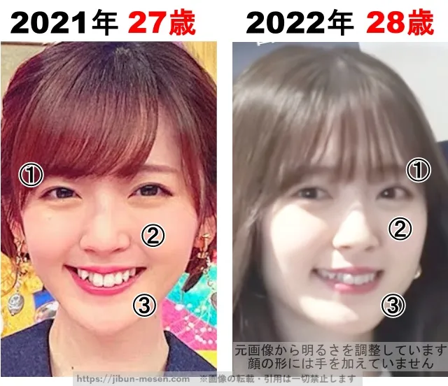 鈴木愛理の整形検証2021年〜2022年