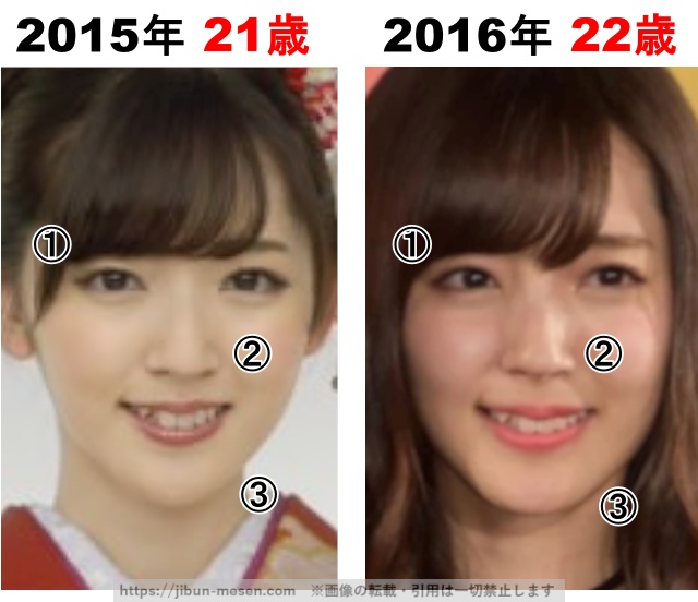 鈴木愛理の整形検証2015年〜2016年の画像