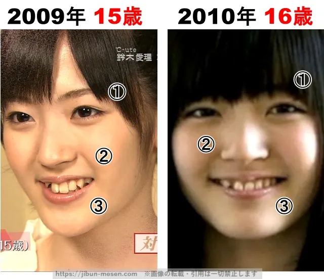 鈴木愛理の整形検証2009年〜2010年