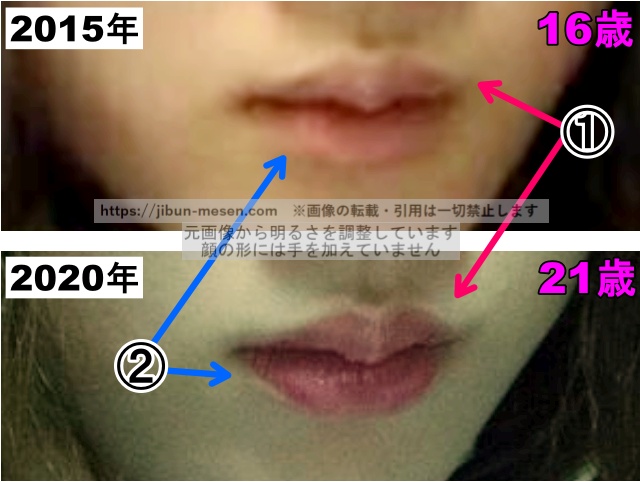 永野芽郁の唇の整形検証2015年〜2020年（拡大）の画像