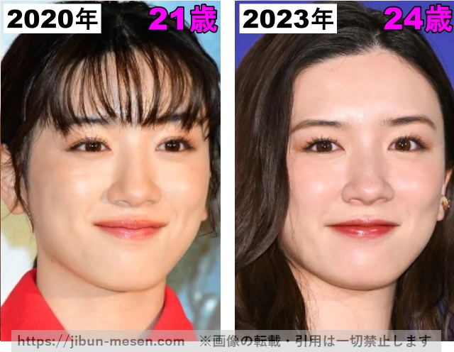 永野芽郁の唇の整形検証2020年〜2023年の画像