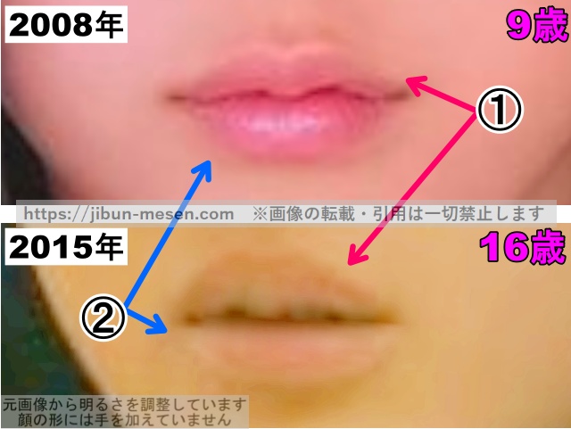永野芽郁の唇の整形検証2008年～2015年（拡大）の画像