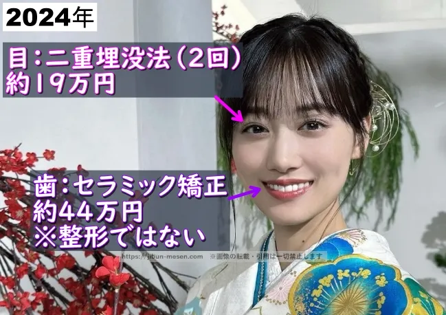 山下美月が整形した箇所とその費用の画像