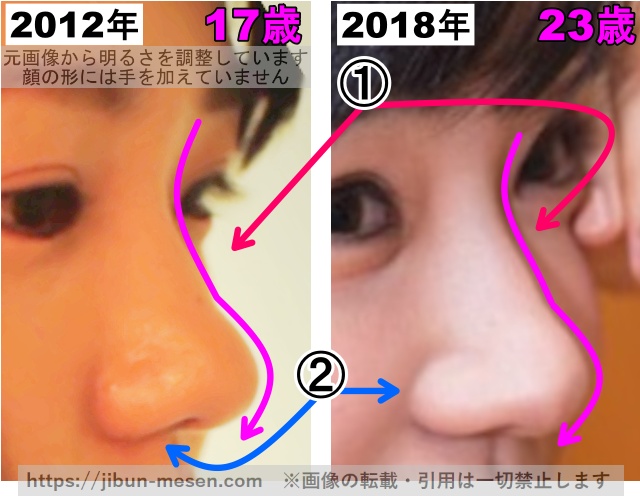 奈緒の鼻の整形検証2012年〜2018年（横顔・拡大）の画像