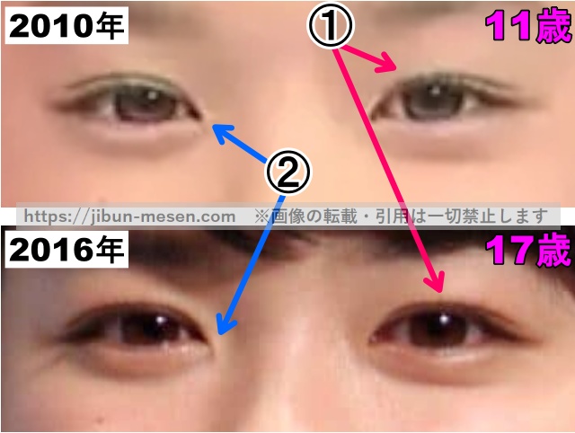 永野芽郁の目の整形検証2010年〜2016年（拡大）の画像