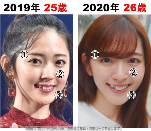 鈴木愛理の整形検証2019年〜2020年の画像