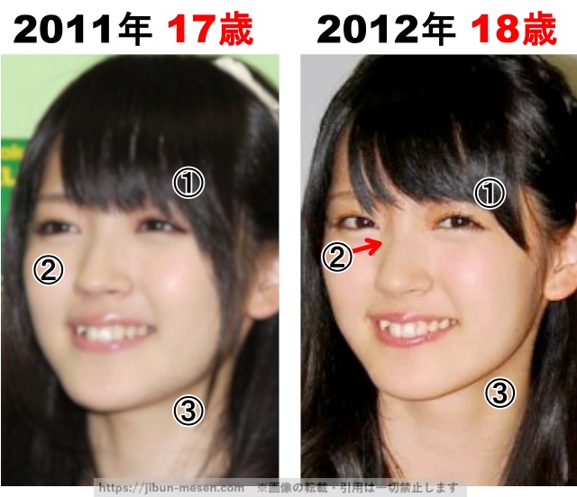 鈴木愛理の整形検証2011年〜2012年の画像