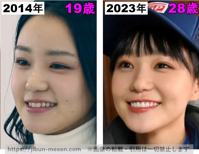 奈緒の唇の整形検証2014年〜2023年の画像