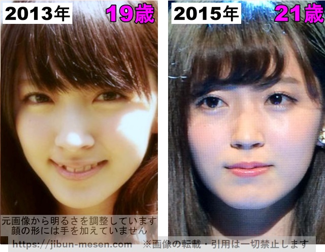 鈴木愛理の目の整形検証2013年〜2015年の画像