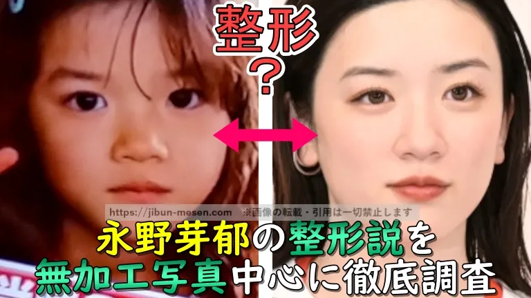 永野芽郁の整形説を無加工写真中心に徹底調査