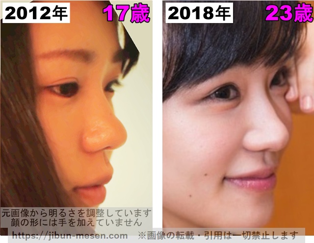 奈緒の鼻の整形検証2012年〜2018年（横顔）の画像